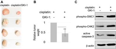 The MASTL-ENSA-PP2A/B55 axis modulates cisplatin resistance in oral squamous cell carcinoma